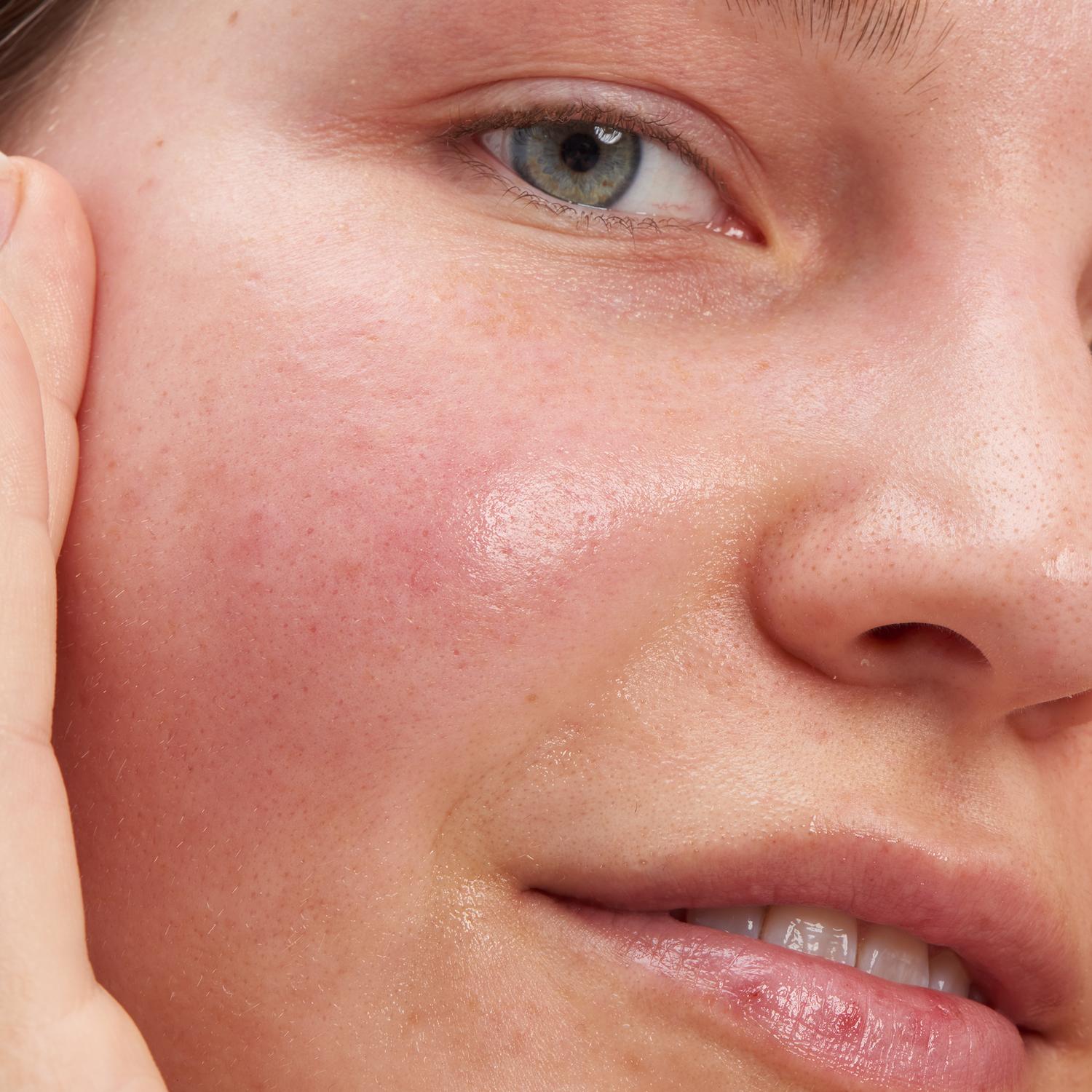 GLYCOLIC ACID EXFOLIATING TONER (TÓNICO EXFOLIANTE)